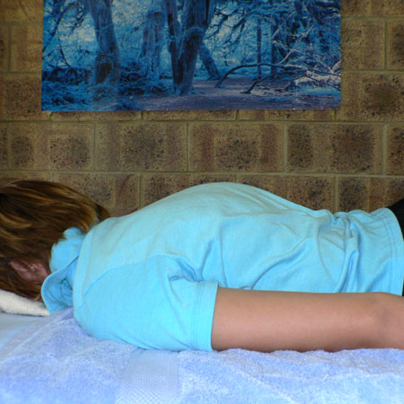 Kyphosis, 14yr girl - Before Bowen Treatment